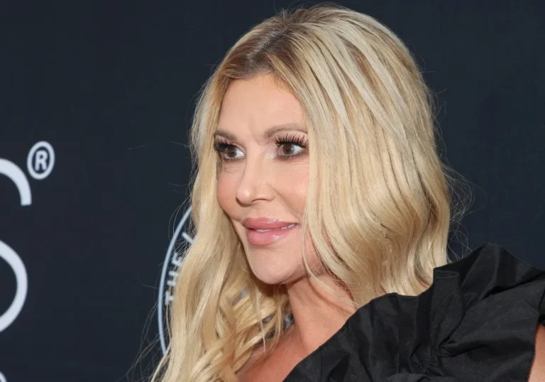 Le hack de bricolage de Brandi Glanville pour le parasite facial «peut provoquer des brûlures chimiques», avertit le docteur